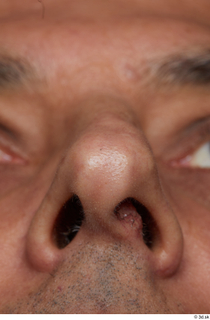 HD Face Skin Reuben Panjaitan face nose skin pores skin…